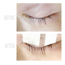 驚きのまつげ育毛効果！