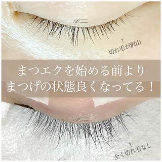 まつげトリートメント