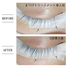 たった１回でこの効果！！