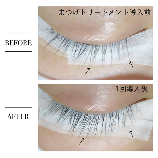 まつげが細い!短い!少ない!とお悩みの方にオススメのまつげトリートメント