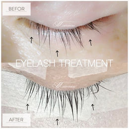 マツエクは時々休んだ方がいいの？