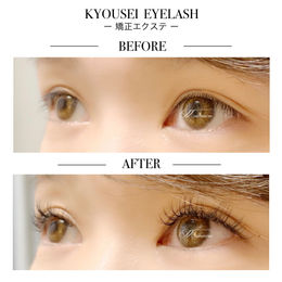 下向きまつげにもう悩まなくていい!