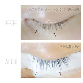 まつげ美容液の効果にびっくりです！！