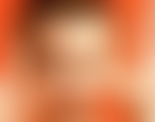 Bumetanida no Autismo: o que sabemos até agora