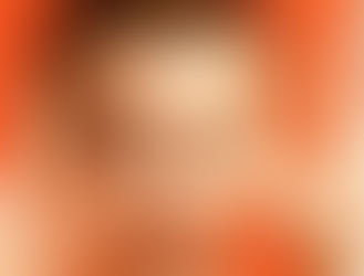 BUMETANIDA NO TEA - OS ESTUDOS CONTINUAM. 