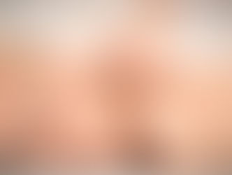 ACUPUNTURIATRA - ACUPUNTURA - Post 1 Acupunturiatria.