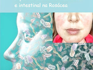 Rosacea e Microbioma. Post 45 Microbioma.