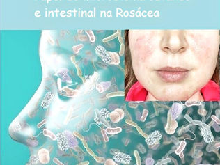 Rosacea e Microbioma. Post 45 Microbioma.
