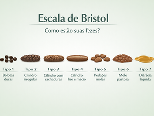 🚽 Intestino preso: por que acontece e como melhorar