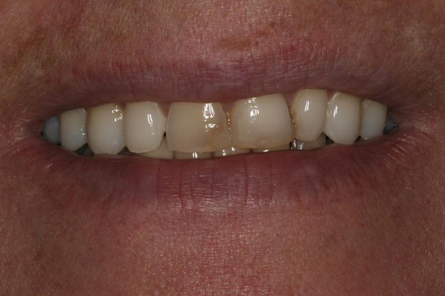 Patient 3 Before