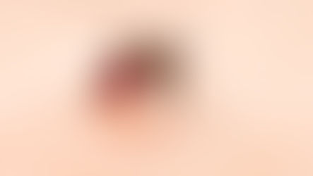 malaria prophylaxis Singapore, malarone price Singapore, travel vaccines Singapore, travel medication, atovaquone proguanil, pre-travel teleconsultation, clinic malaria prevention