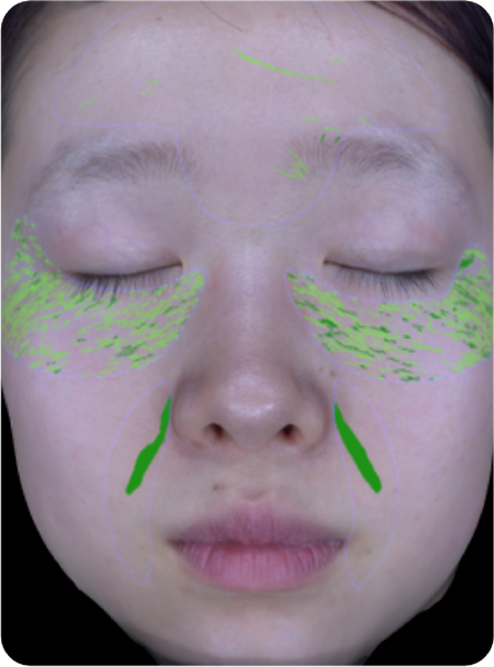 3D skin analyzer mchine  Factory