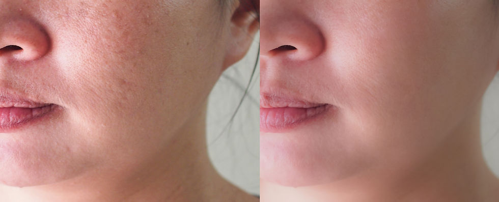 Thumbnail: The Afterglow