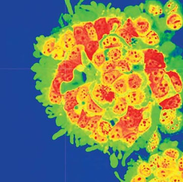 Breast-Cancer-Cells_sqcrop_web-480x480.jpg