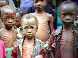 Verhungerte Kinder
