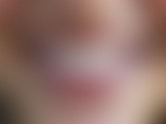 Riscoprire il Sorriso: Casi Reali di Riabilitazione Estetica con Faccette e Corone in Ceramica