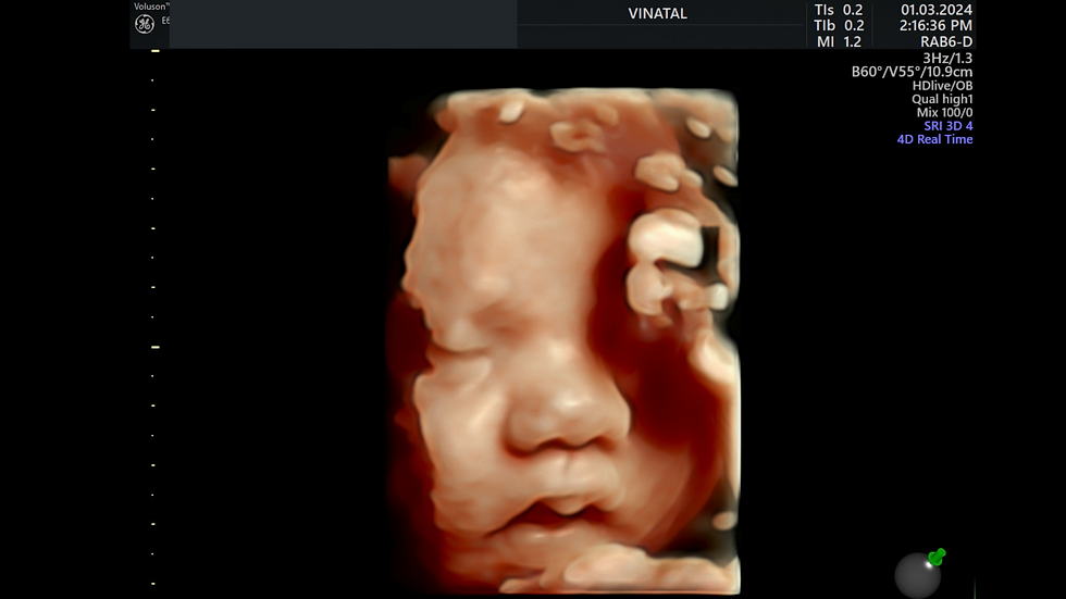 Ultrasonido de tercer trimestre hemodinamia fetal