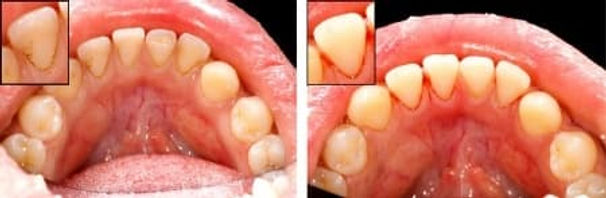 Dental_Hygienist_1.jpg