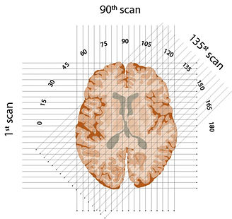 x-rays_beam_through_brain.jpeg