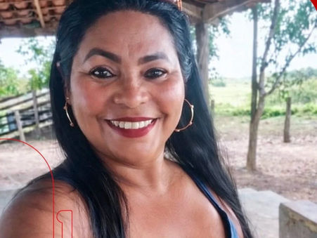 Tragédia em Bacabal: mulher morre após ataque de pitbull dentro de fazenda