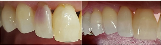 restauration.jpg