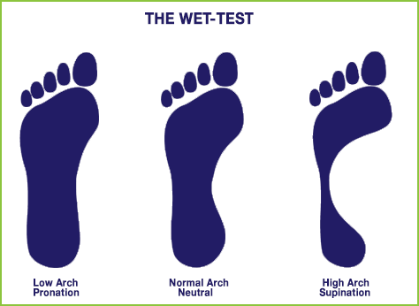 low arch supination running shoes