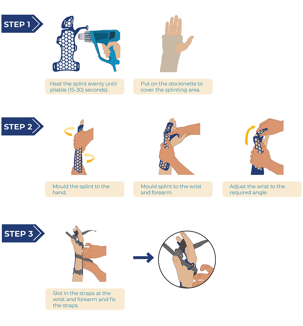 Gutter Splinter IFU Ulna Gutter Splint | Cre-AID LABS