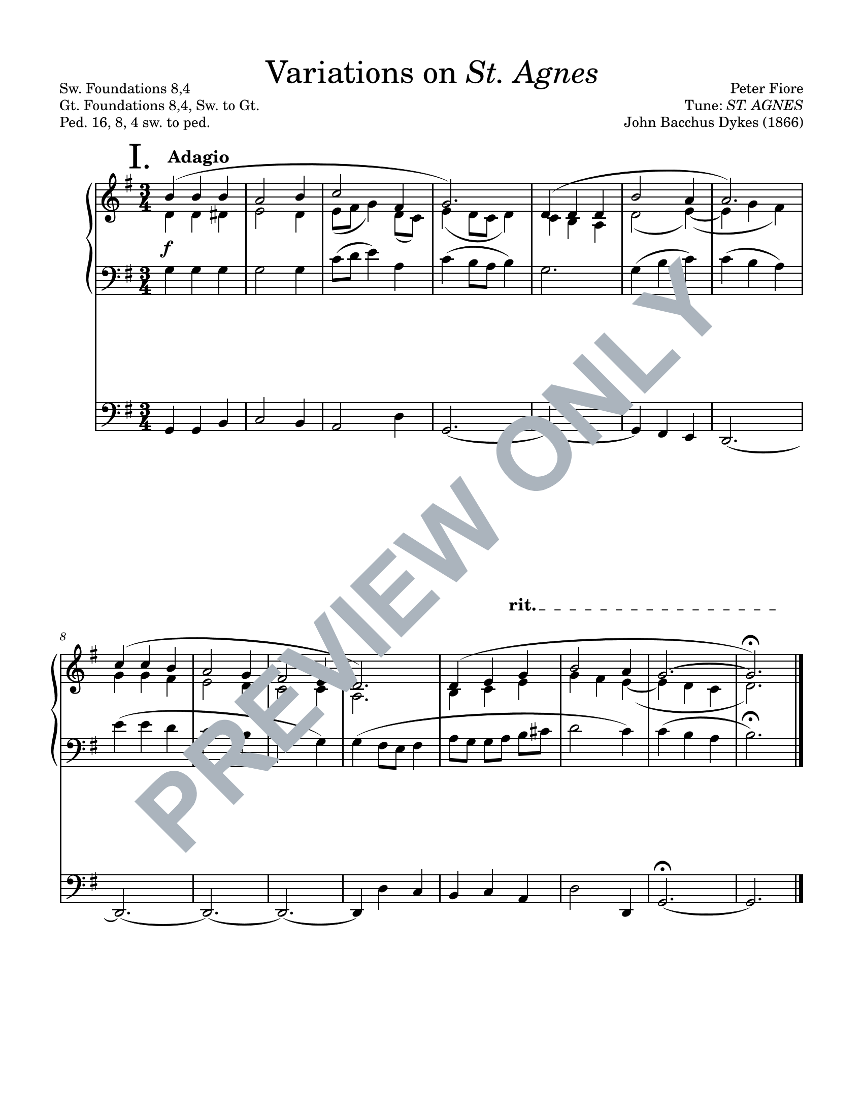 Variations on "St. Agnes"