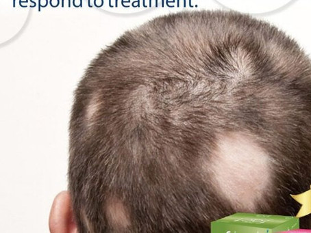 corticosteroids are useful in treating scarring alopecia in immune deficient patient? what is the tr