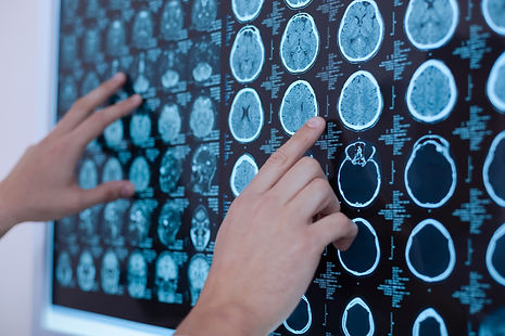 Imagerie Oncologique