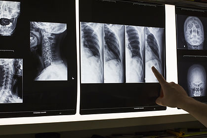 Radiographie