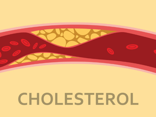 Tại Sao Omega-3 Là Thực Phẩm Chức Năng Hỗ Trợ Tim Mạch Tốt Nhất?