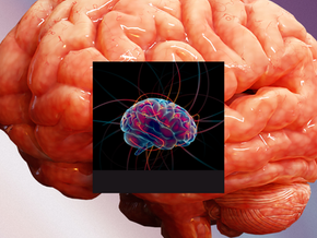 Does music improve neuroplasticity? How can we also use it for mental well-being?