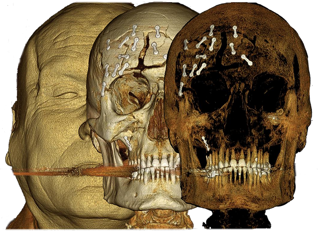 OS3D_tissue density 3D