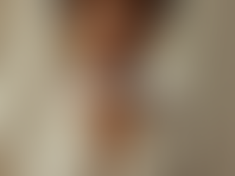 How to Prevent Hyperpigmentation Before It Starts