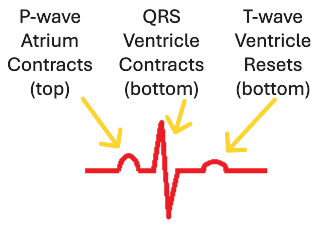 Image of P-QRS-T complex, with different parts labeled.