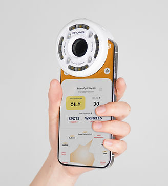Mobile hair analyzer