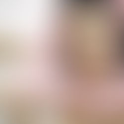 Before & After: Setting Realistic Expectations from a Short Scar Facelift