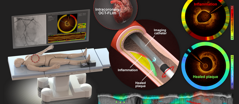 2025 카이스트 대표 연구 성과 10선 선정 (Selected for the 2025 KAIST Top 10 Research Achievements)