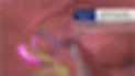 cardiovascular-disease_저화질-1-1024x575.png