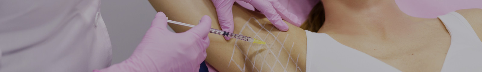 MV-Transpiration excessive