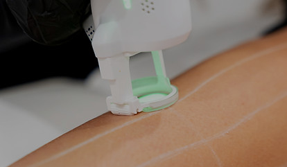 MV-Soins Médico-Esthétique