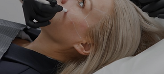 Sculptra-1_edited.png