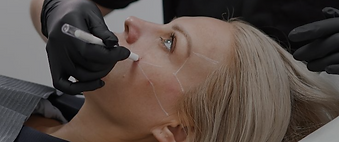 Sculptra-1_edited.png