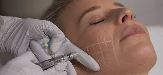 MV-raffermissement de la peau