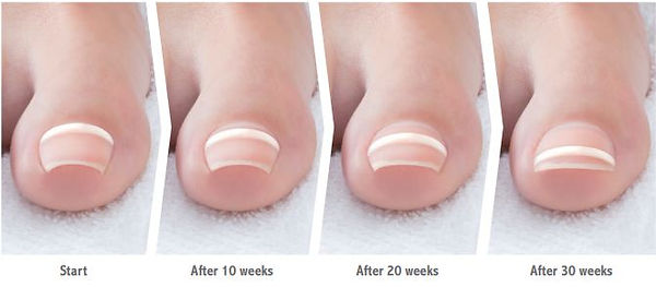 Before-and-after.jpg