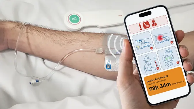 Timertag Pro label affixed to a routine peripheral IV securement dressing with a user holding a smartphone near the label. A user experience screen is displayed showing patient engagement illustrations for managing their routine peripheral IV, as well as the current dwell time for the peripheral IV. The dwell time is displayed within a yellow screen because the dwell time has now passed 72 hours.