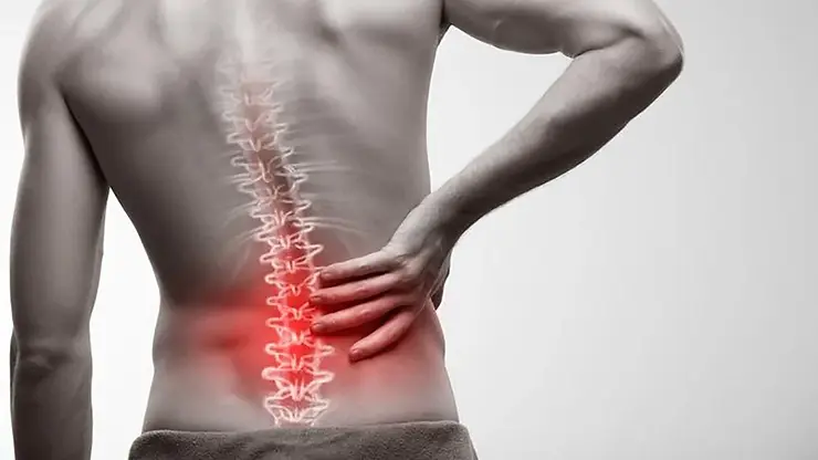 ¿Dolor en la espalda baja? Descubre si es lumbago y cuándo es necesario estudiarlo