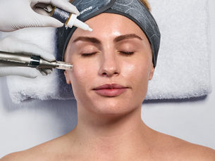 Discover Exosomes with Dermalogica's Exo booster Microneedling