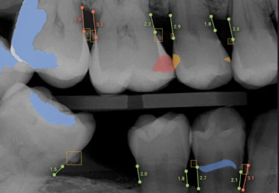 Tired of Patients Not Understanding Their Treatment? Here’s How AI Can Help
